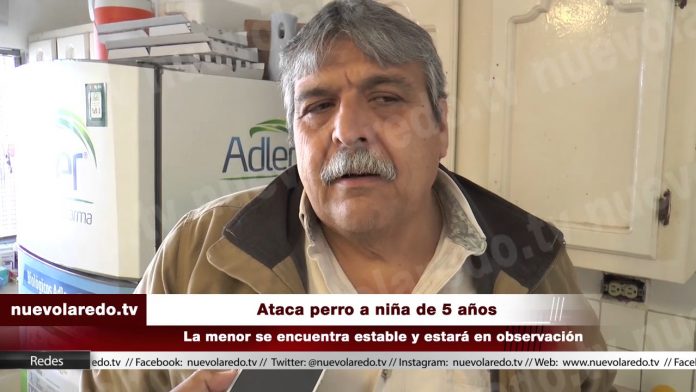 Ataca perro a niña de 5 años en el rostro; van 17 agresiones este año (VIDEO)